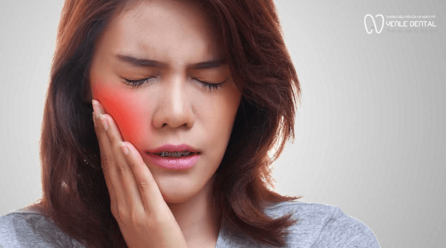 dấu hiệu viêm lợi trùm răng khôn